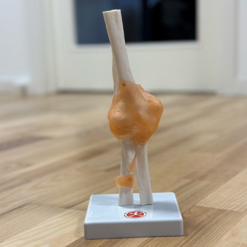 Albueled Fuld Størrelse